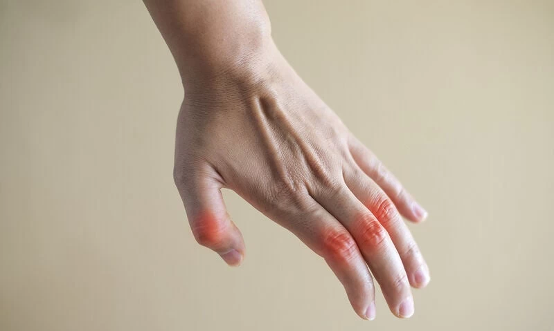 Ρευματοειδής αρθρίτιδα: Το μπαχαρικό που προκαλεί υποχώρηση των συμπτωμάτων